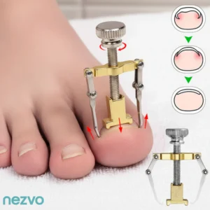 correcteur d’ongles incarnés